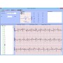 Monitor ECG de mana MD100B